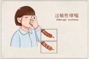 过敏性哮喘