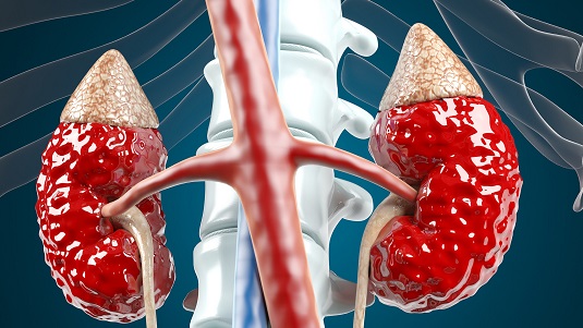 经常性腹痛、腿抽筋、视力下降，很有可能是高血脂症！