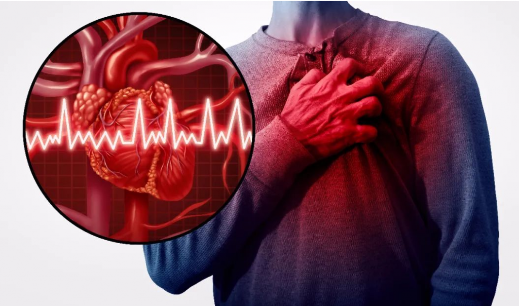 体检报告里查出来“窦性心律不齐”，是猝死的信号吗？