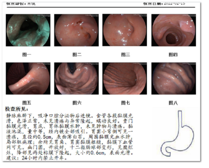 胃溃疡出血是什么症状？这些肠胃的异常表现你要清楚！