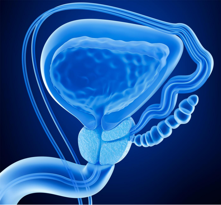 前列腺增生是什么原因引起？男性都要关心的前“腺”话题！