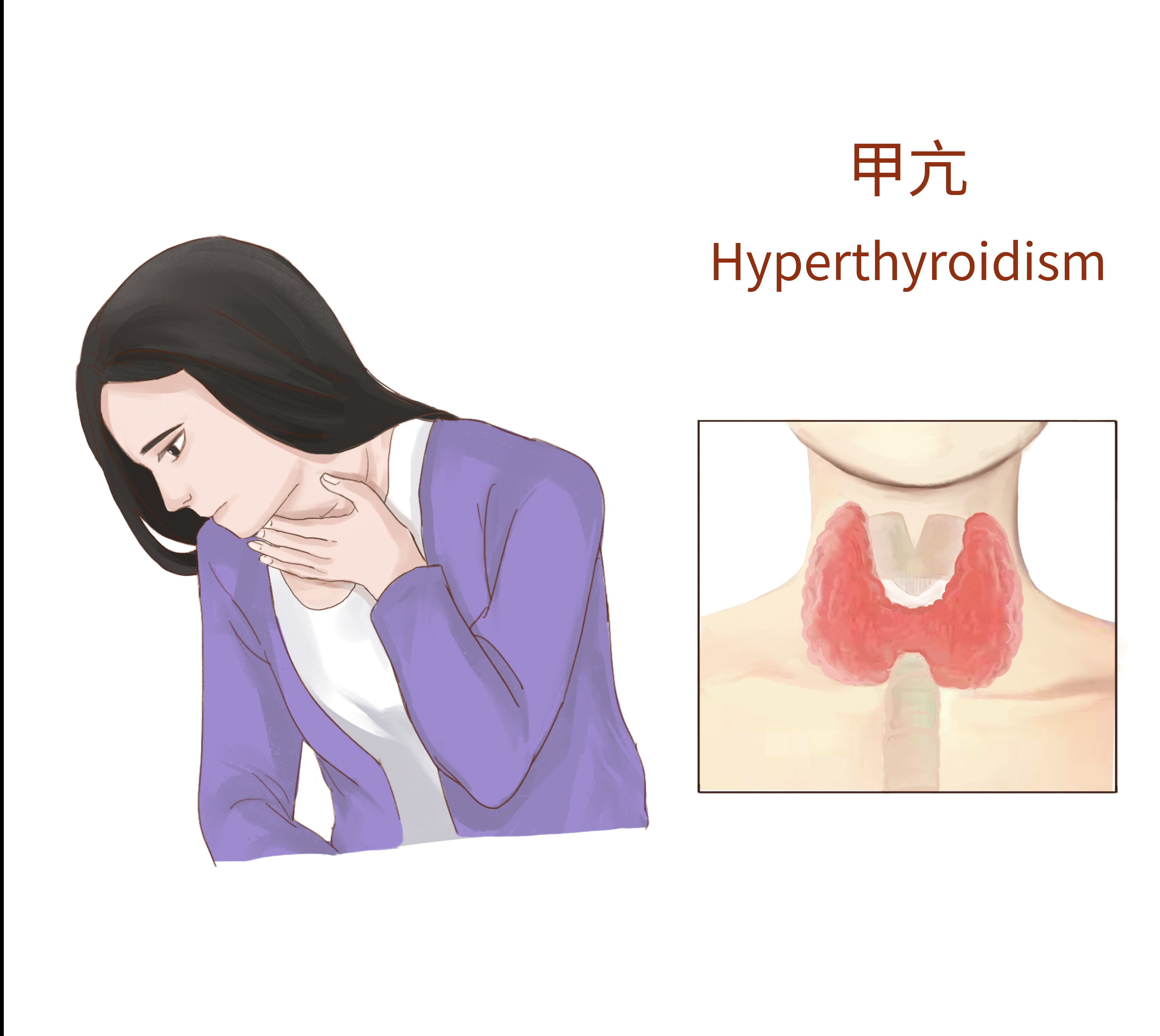 甲亢是一种什么病？为什么会让近3000万人闻风丧胆？