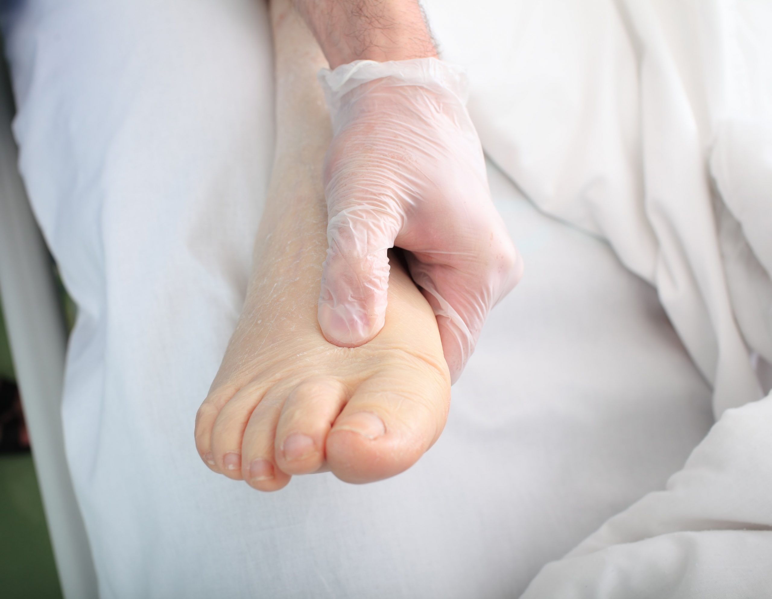脚浮肿是什么原因引起的？身体好不好，看脚就知道——薛医生